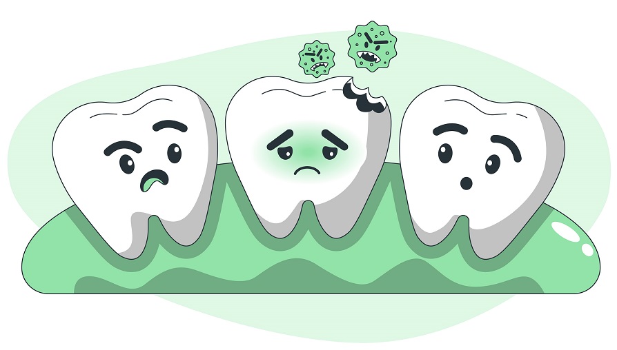 dental caries